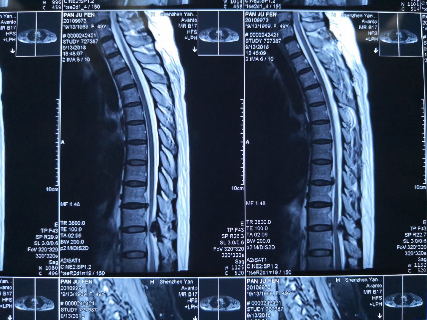 胸亚利人口_亚利盖拉(3)