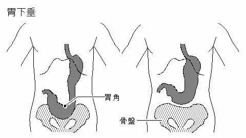 饭后散步会致胃下垂?知道真相的我眼泪掉下来.