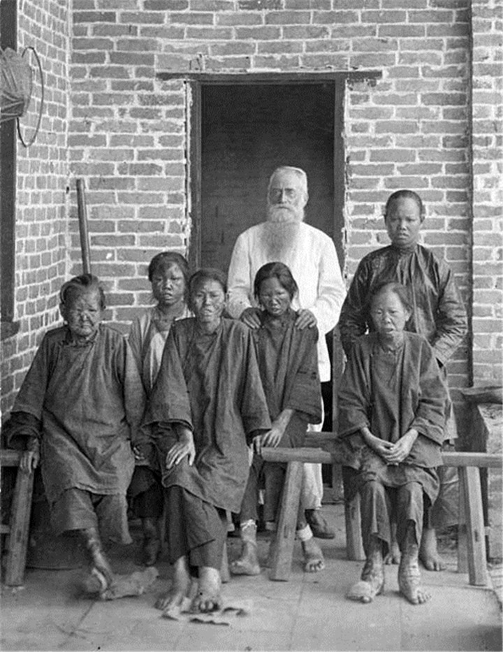 1/ 9 1,民国初期麻风病患者(1914年)图文/普希金皇村.