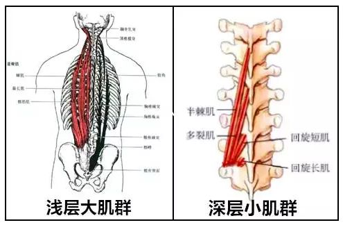 在维持一种姿势时需要保证脊柱椎体之间的稳定,这通常是由【多裂肌】