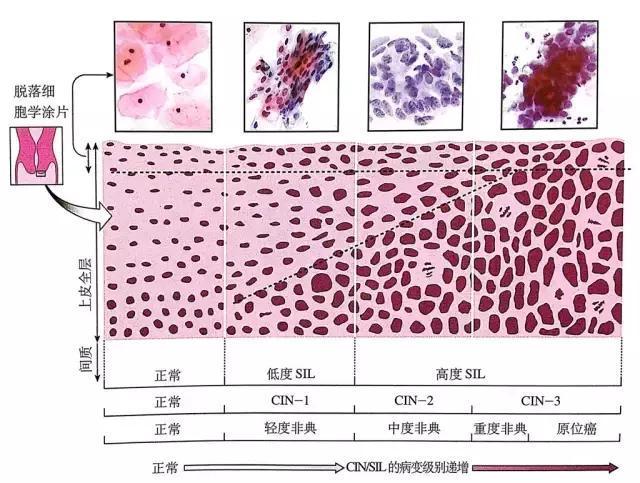 阴道镜下宫颈活检患者健康教育需求的调查分析