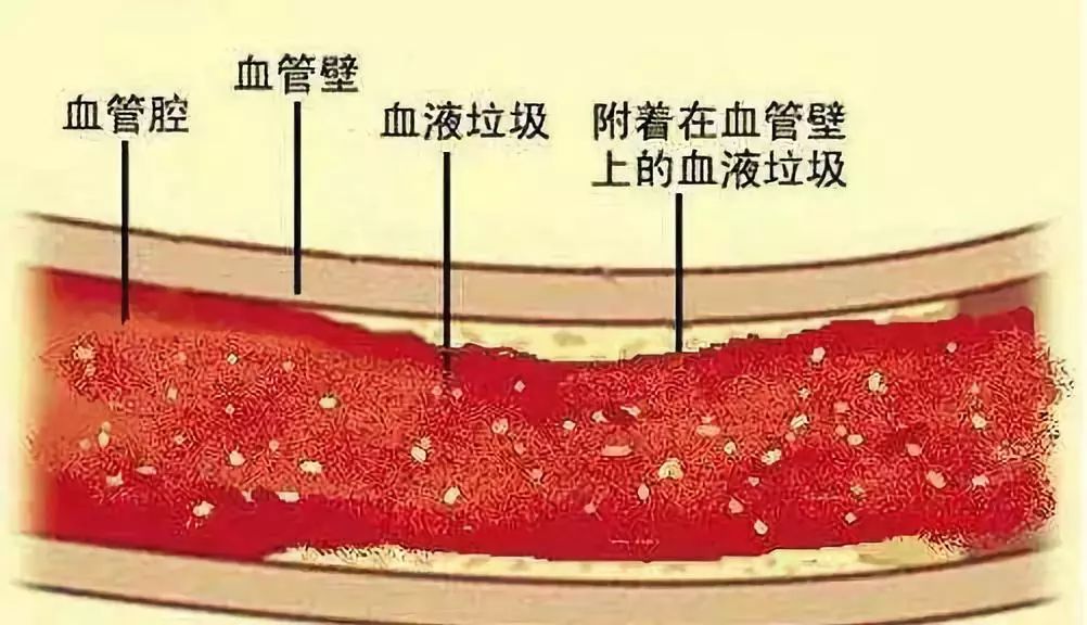 会启动自身的排毒系统,而当排毒系统无法消化这些血液"垃圾"的时候