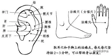 中风偏瘫,"治瘫点"是最方便的疗法