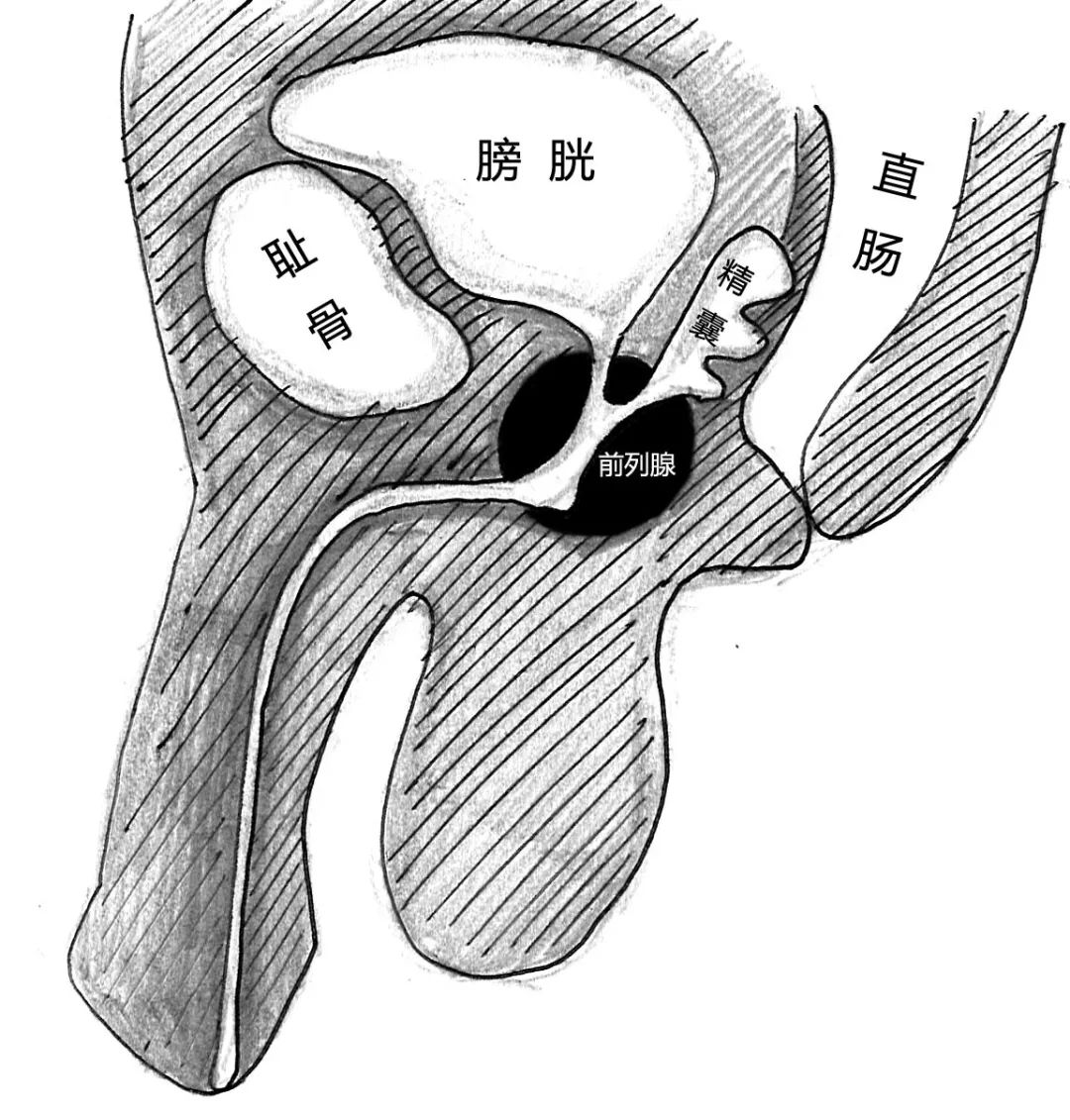 前列腺是男性生殖器附属腺中最大的一个实质器官,位于膀胱下部,紧包