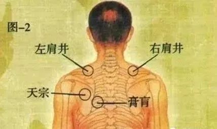 第2步:疏通颈肩部位 ● 颈肩部位,主要灸透3个穴位:肩井,颈夹脊