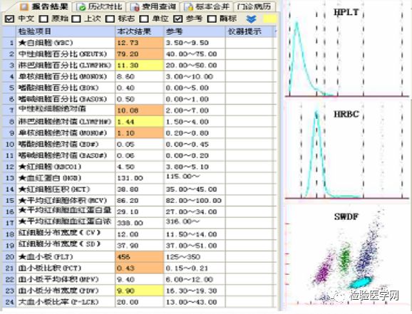 三日后病人再次化验血常规,这次是在迈瑞cal-8000血细胞分析仪是检测
