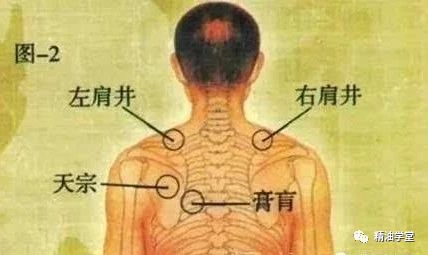 2 第2步:疏通颈肩部位 颈肩部位,主要灸透3个穴位:肩井,颈夹脊,大椎.