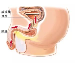 老人上厕所上不出来怎么办