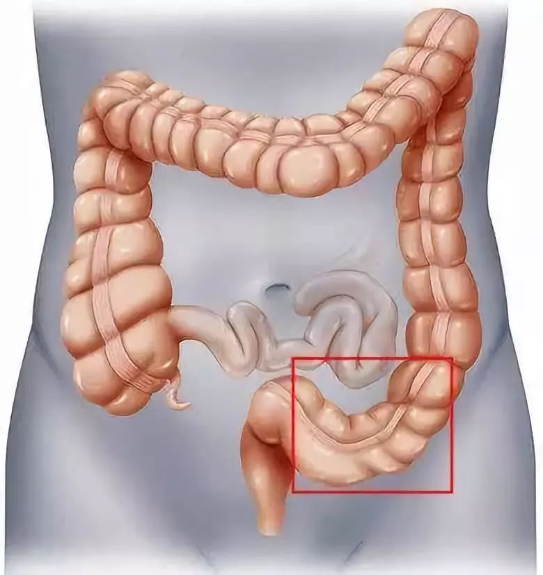 1,腹部按摩 顺着肠道蠕动的方向,以顺时针的方向画圈按摩每次10圈,且