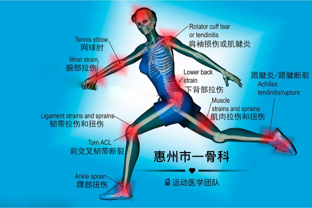 世界流行的运动损伤及康复的无损伤疗法贴扎技术