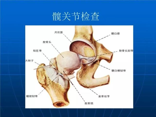 全髋关节置换术让患者告别疼痛不再是梦