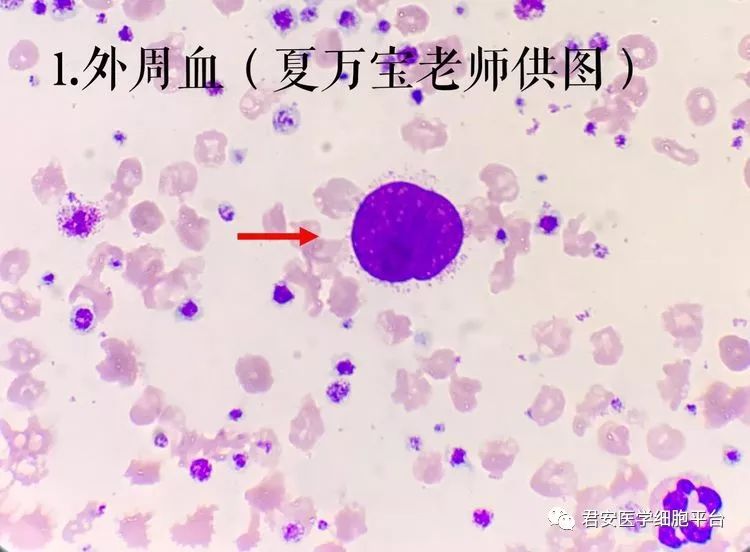 王佳怡--杭州医学院审核者:段爱军--河南信合医院来源于:君安医学细胞