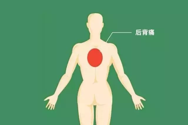后背痛:以腰部,背部,肩部的放射性疼痛为主.