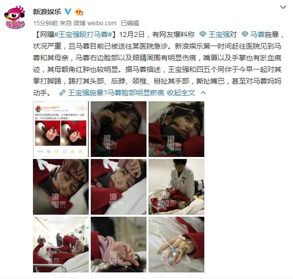 王寶強被曝對馬蓉大打出手，女方的臉部有明顯傷痕，現在已住院