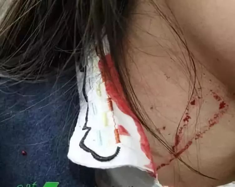 恐怖!宜宾一男子用菜刀将妻子砍得满脸是血,只是因为