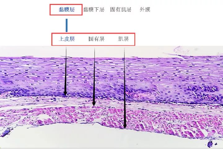 早癌诊断基础|食管黏膜层微血管结构表现