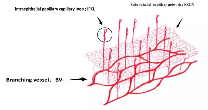 上皮乳头内毛细血管袢:ipcl(图14)图14黑色框内红色的红细胞显示为