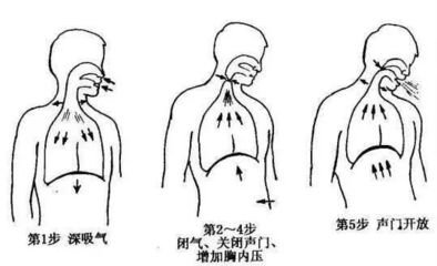 2,拍背排痰(痰多不易咳出者;患者术后24h内,每1～2h翻身叩背,咳嗽