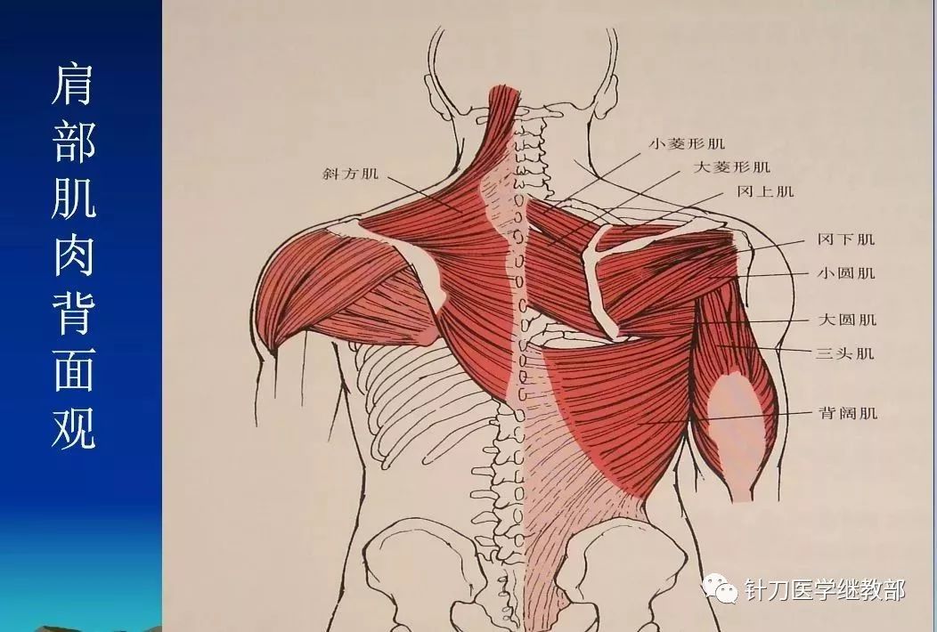 肩周炎的针刀治疗 立竿见影