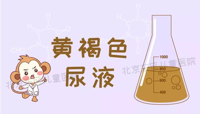 赤褐黄绿黑蓝白,哪些颜色的尿尿最危险?_尿液