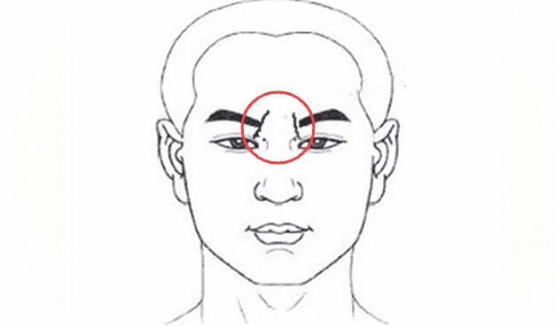 又称命宫,如果两眉之间长有一条竖纹的话,这条纹又称悬针纹或斩子纹