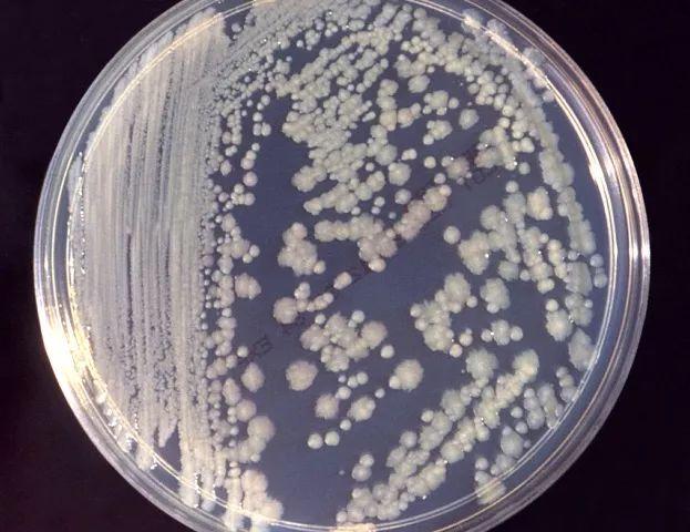 在培养皿里繁殖的下水道肠杆菌.cdc