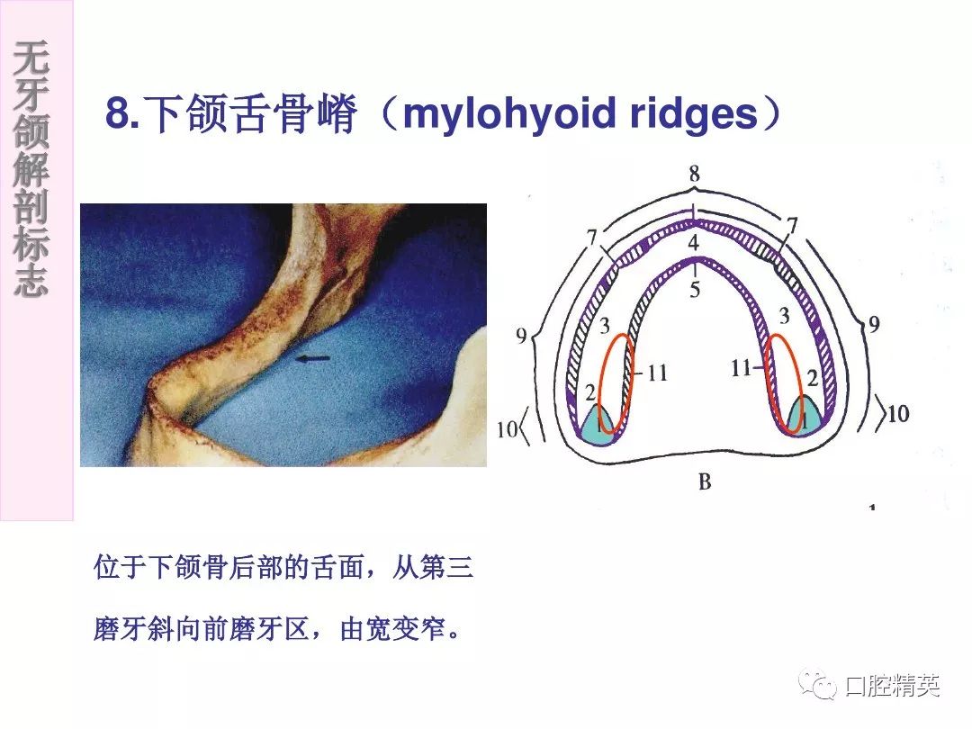 无牙颌解剖标志