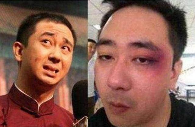 人說他是王寶強第二，被妻子打得鼻青臉腫，還被「偷」走全部財產 娛樂 第6張