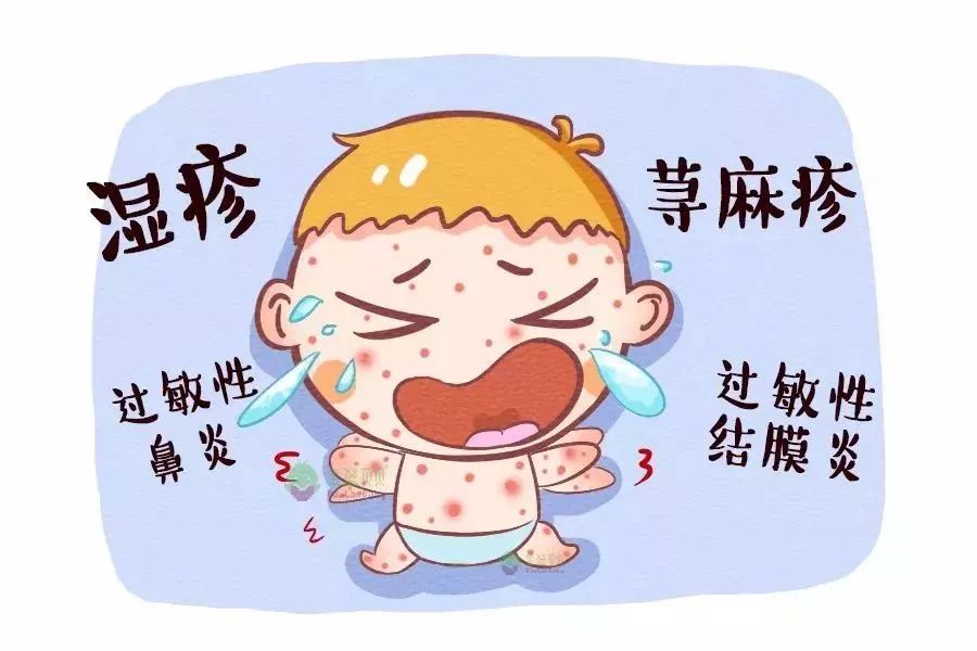 湿疹:有时没有红疹的皮肤干,痒也是过敏的表现;而宝