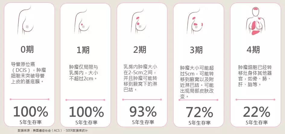 乳腺癌竟有这些类型,病历本上怎么看?_分型