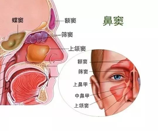 你真的了解鼻窦炎吗?