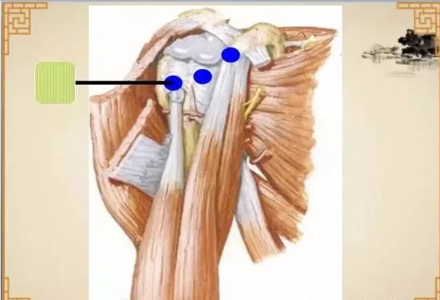 针刀治疗肩周炎诊断与解剖