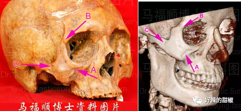 天使宝贝的哪一个下巴最好看_颧骨