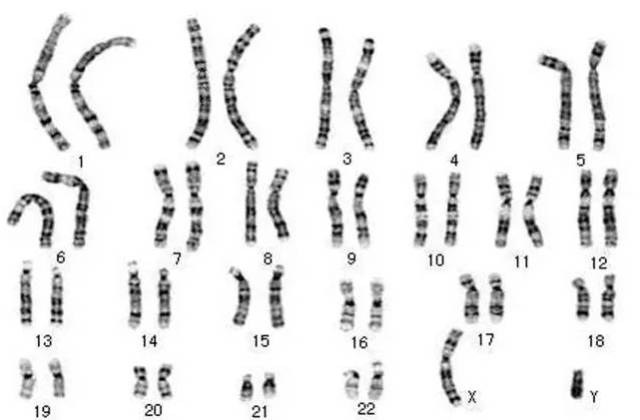 染色体怎么看数目