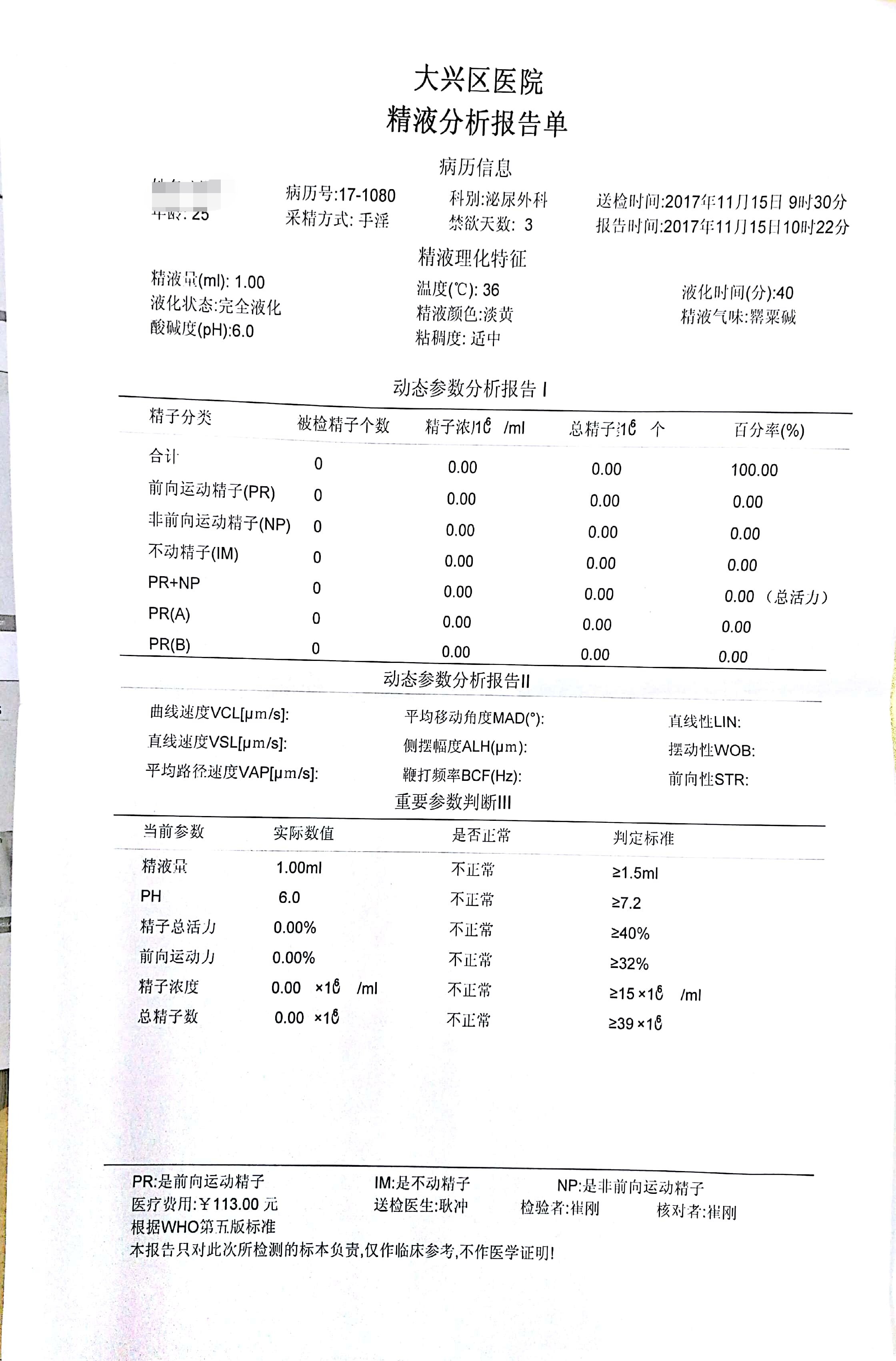 xxy或azf缺失,需要积极寻找无精症病因(染色体核型和y染色体微缺失)