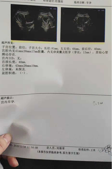 双侧输卵管堵塞积水,成功怀孕,给大家一点正能量