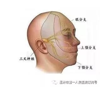 三叉神经疼怎么办