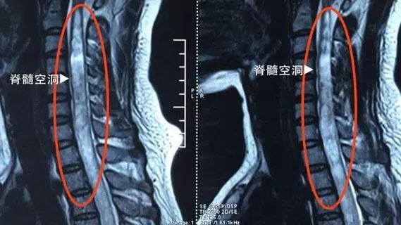 做核磁内衣_幼儿做核磁图片(2)