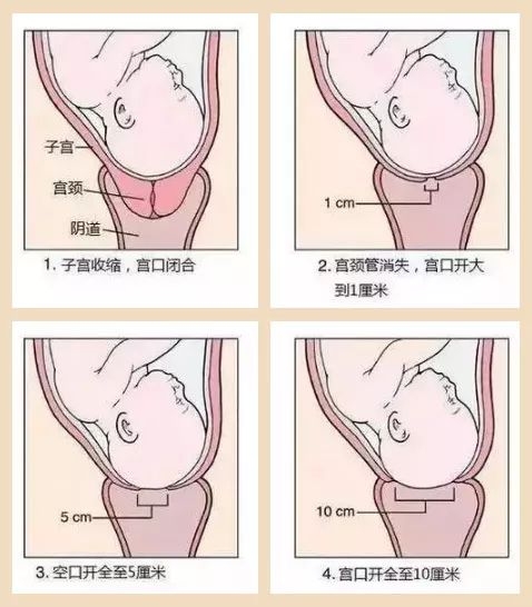 顺产时所谓的开十指很多宝妈开5指就受不了了