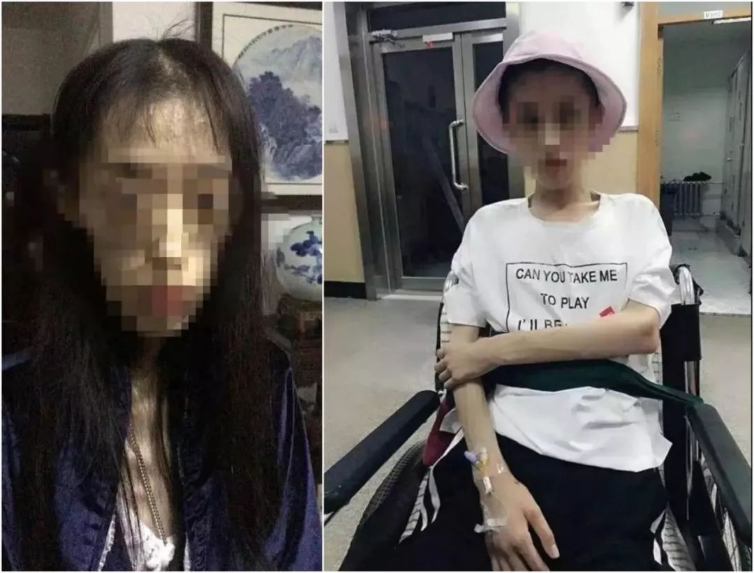 沉迷骨瘦如柴自杀式减肥毁了多少女孩