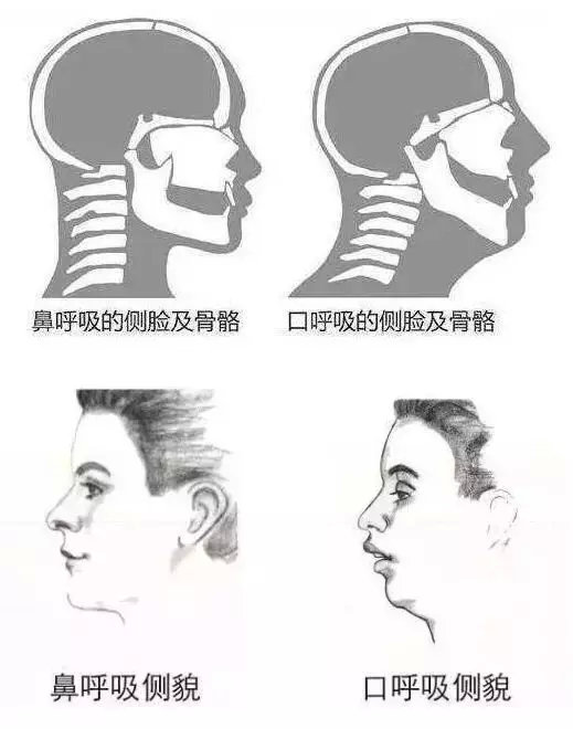 3种办法教你缓解打