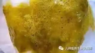 寶寶大便圖鑒：便便裡竟藏著疾病秘密 健康 第15張