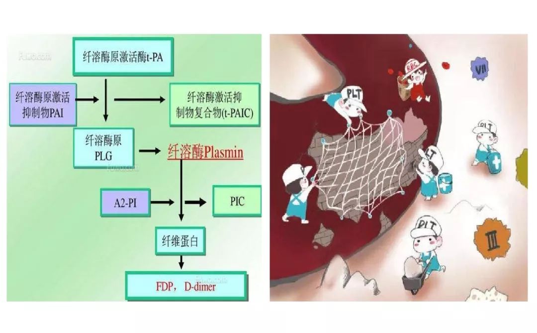 当抗凝遇上出血如何预防dvt