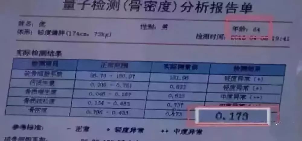 尤其是60岁以上的人,骨密度低于正常值,                    差,一掰