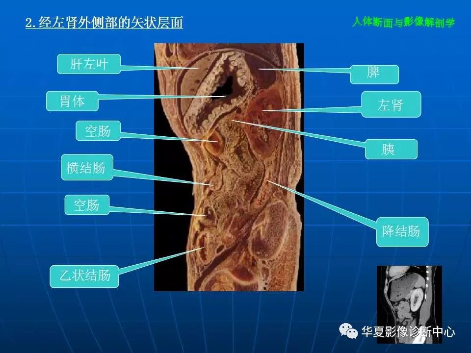 腹部断层影像解剖(续)