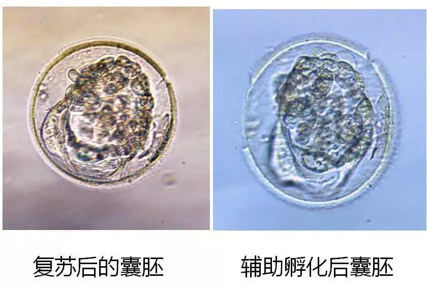 而冷冻胚胎移植周期,则需通过人为控制子宫内膜发育速度或细致地监测