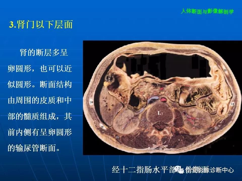 腹部断层影像解剖