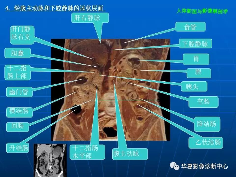 腹部断层影像解剖续