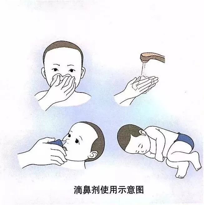 滴鼻剂 用药指导