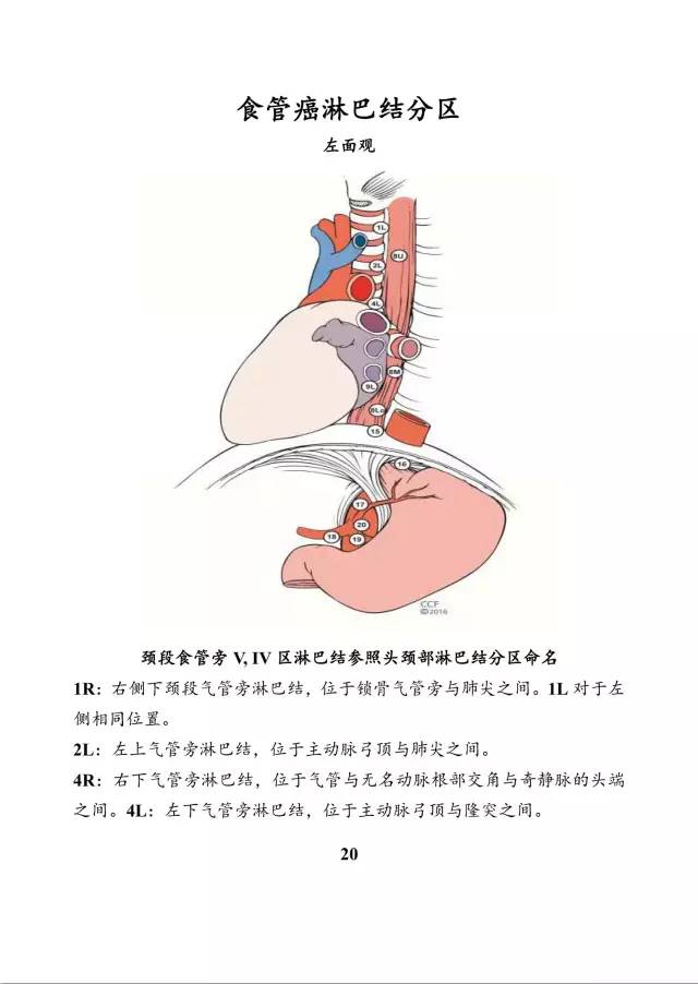 然而并无胸导管旁淋巴结的定义但是,由于不同研究的手术和解剖方式不